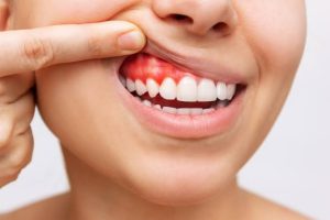 Dentiste à Mecidiyeköy : des soins dentaires adaptés à chaque besoin 1 Dentiste à Esenyurt